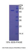 Rat Breast Cancer Susceptibility Protein 1 (BRCA1) Protein