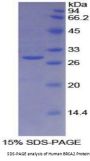 Human Breast Cancer Susceptibility Protein 2 (BRCA2) Protein