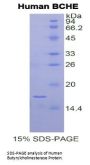 Human Butyrylcholinesterase (BCHE) Protein