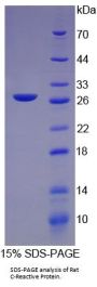 Rat C Reactive Protein (CRP) Protein