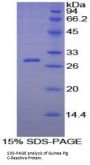 Guinea pig C Reactive Protein (CRP) Protein