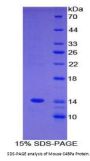 Mouse C4b-Binding Protein Alpha Chain (C4BPA) Protein