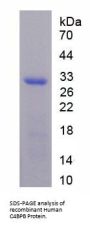 Human C4b-Binding Protein Beta Chain (C4BPB) Protein