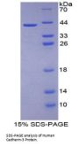 Human Cadherin-3 (CDH3) Protein