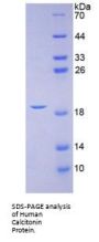 Human Calcitonin Gene Related Peptide 2 / CGRP2 (CALCB) Protein
