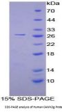 Human Calcium/Calmodulin Dependent Protein Kinase II Gamma (CAMK2g) Protein
