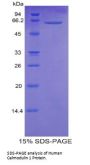 Human Calmodulin 1 (CALM1) Protein