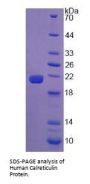 Human Calreticulin (CALR) Protein