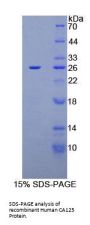 Human Carbohydrate Antigen 125 (CA125) Protein