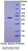 Mouse Carbonic Anhydrase I (CA1) Protein