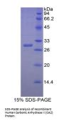 Human Carbonic Anhydrase II (CA2) Protein