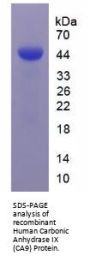 Human Carbonic Anhydrase IX (CA9) Protein