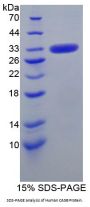 Human Carbonic Anhydrase VB, Mitochondrial (CA5B) Protein