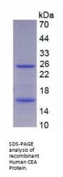 Human Carcinoembryonic Antigen-Related Cell Adhesion Molecule 5 (CEACAM5) Protein