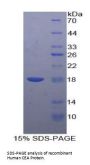 Human Carcinoembryonic Antigen-Related Cell Adhesion Molecule 5 (CEACAM5) Protein