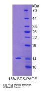 Human Carcinoembryonic Antigen Related Cell Adhesion Molecule 7 (CEACAM7) Protein