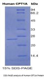 Human Carnitine Palmitoyltransferase 1A, Liver (CPT1A) Protein