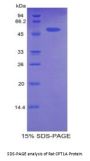 Rat Carnitine Palmitoyltransferase 1A, Liver (CPT1A) Protein