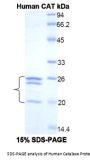 Human Catalase (CAT) Protein
