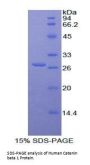 Human Catenin Beta 1 (CTNNb1) Protein