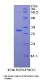 Rat Catenin Beta 1 (CTNNb1) Protein