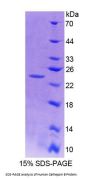 Human Cathepsin B (CTSB) Protein