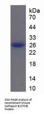 Mouse Cathepsin B (CTSB) Protein