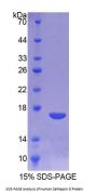 Human Cathepsin D (CTSD) Protein