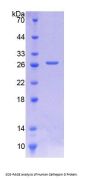 Human Cathepsin D (CTSD) Protein
