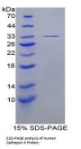 Human Cathepsin K (CTSK) Protein