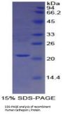 Human Cathepsin L1 (CTSL) Protein