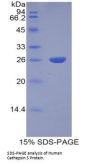 Human Cathepsin S (CTSS) Protein