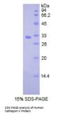 Human Cathepsin L2 / CTSL2 (CTSV) Protein