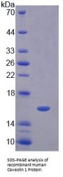 Human Caveolin 1 (CAV1) Protein