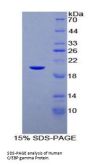 Human CCAAT/Enhancer Binding Protein Gamma (CEBPg) Protein
