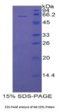 Rat CD5 Antigen Like Protein (CD5L) Protein