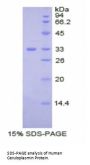 Human Ceruloplasmin (CP) Protein