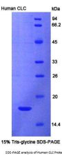 Human Charcot Leyden Crystal Protein (CLC) Protein