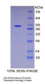 Human Checkpoint Homolog 2 (CHEK2) Protein