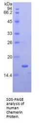 Human Chemerin (RARRES2) Protein