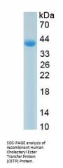 Human Cholesteryl Ester Transfer Protein (CETP) Protein