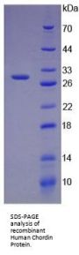 Human Chordin (CHRD) Protein