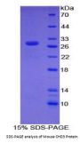 Mouse Chromodomain Helicase DNA Binding Protein 3 (CHD3) Protein