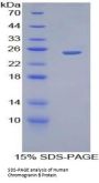 Human Chromogranin B (CHGB) Protein