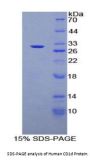 Human Antigen-Presenting Glycoprotein CD1d (CD1D) Protein