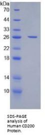 Human OX-2 Membrane Glycoprotein (CD200) Protein