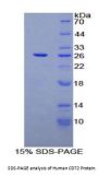 Human B-Cell Differentiation Antigen CD72 (CD72) Protein