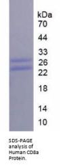 Human T-Cell Surface Glycoprotein CD8 Alpha Chain (CD8A) Protein