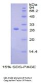 Human Coagulation Factor IX (F9) Protein