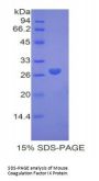 Mouse Coagulation Factor IX (F9) Protein